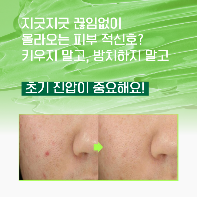 Troubless 클리어 젤 크림 (스팟) 15ml