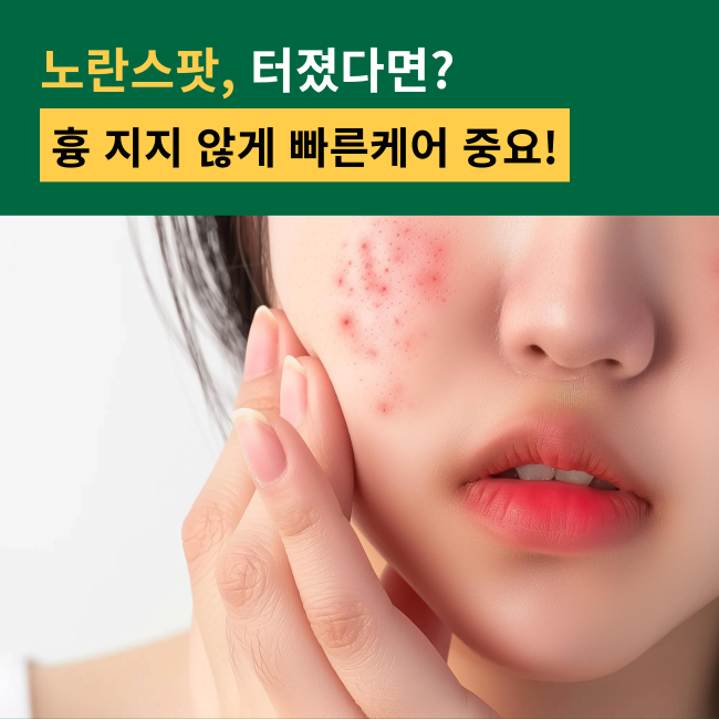 Troubless 인비저블 플러스 스팟패치 더 클래식 96패치